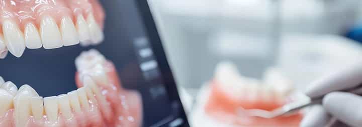 اندو(درمان ریشه دندان)