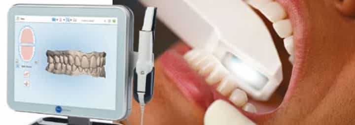 کشیدن دندان عقل